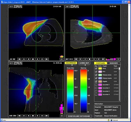 Simulación de radioterapia usando computación distribuida