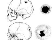 Encuentran Soria cráneos trepanados Edad Media
