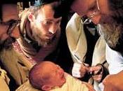 Circuncisión recién nacido