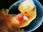 aborto desde punto vista científico