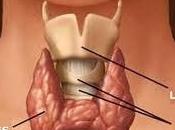 Tiroidectomía para tratar apnea obstructiva sueño