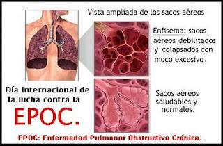 DIA INTERNACIONAL DE LUCHA CONTRA LA EPOC