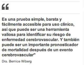 Un dibujo puede mostrar el riesgo de un derrame cerebral.