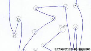 Un dibujo puede mostrar el riesgo de un derrame cerebral o evento cerebrovascular