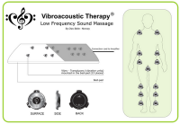 Uso de la Terapia Vibroacústica en Lesiones Neurológicas