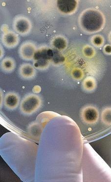 Un experto dice que España tiene que vigilar la E-coli más que otros países
