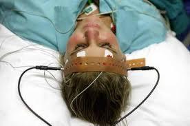 Un estudio explica cómo podría funcionar la terapia electroconvulsiva