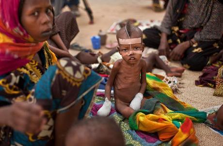 Crisis alimentaria en África.