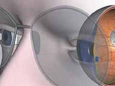 Implante fotovoltáico retina para curar algunos tipos ceguera