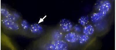 Prueban con éxito la primera terapia para prolongar la vida