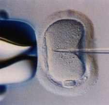 FECUNDACIÓN IN VITRO EN ITALIA