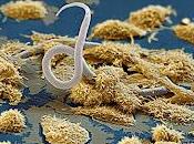 Auranofina para tratar Amebiasis