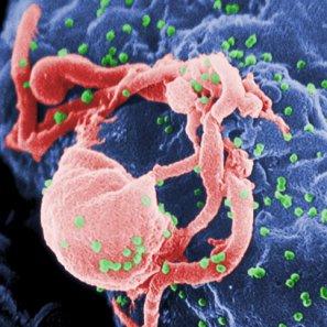 Salud Por Las Malas: ¿VIH Contra El Cáncer?