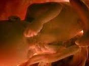 polémica torno aborto post parto