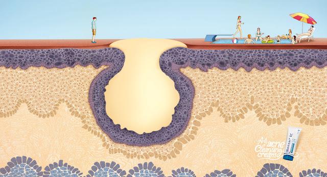 Quita los barros de tu camino