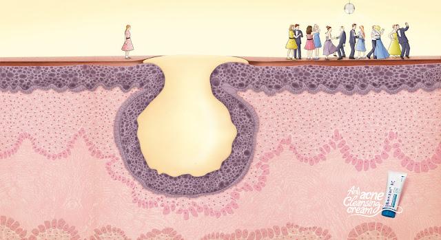 Quita los barros de tu camino