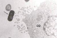 Nueva terapia contra la mastitis en mujeres lactantes