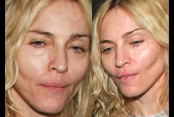 Fotos de Madonna sin Maquillaje o sin Pintura y la cirugia - Paperblog