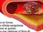 Manejo Antiagulante Oral, Sintrom adecuado