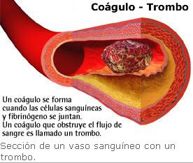 Manejo del Antiagulante Oral, Sintrom uso adecuado