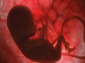 Secuenciacion Genomica Prenatal Invasiva