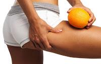 Qué es la celulitis y como evitarla