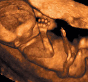 Bienvenido al suicidio de Occidente (I) Bienvenido al suicidio de Occidente (I)