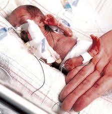 Predecir riesgo de parto prematuro con tecnología