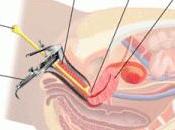 mujeres debería hacerse citología vaginal anual