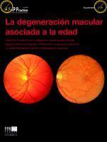 Degeneración macular asociada a la edad (DMAE) (y II)