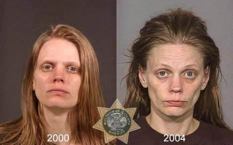 Antes y Después del Consumo de Anfetaminas