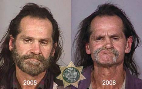 Antes y Después del Consumo de Anfetaminas