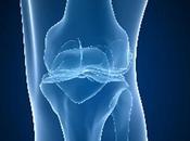 Tipos ejercicios pilates para pacientes artritis rodilla