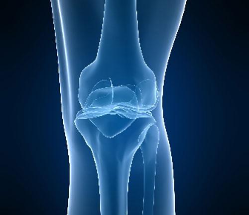 Tipos de ejercicios pilates para pacientes con artritis de rodilla