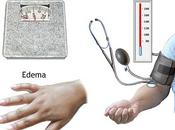 Preeclampsia-Eclampsia.