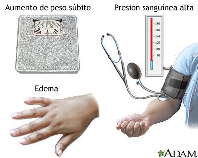 Preeclampsia-Eclampsia.