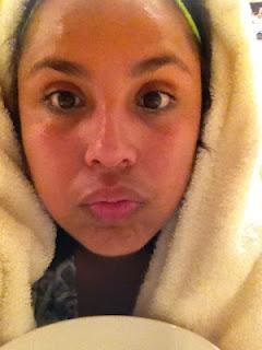 Bye bye Acné Bye bye Acné