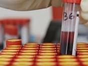 Investigadores desarrollan examen sangre para detectar depresión
