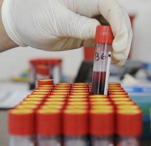 Investigadores desarrollan examen de sangre para detectar depresión
