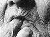 Exitosa prueba vacuna contra Alzheimer