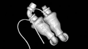 La Vida Sin Corazón, Al Pie De La Letra