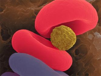 Las inyecciones de oxigeno pueden salvar a pacientes. Las inyecciones de oxigeno pueden salvar a pacientes.