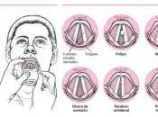 Foniatria