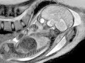 Parto visto desde dentro resonancia magnética
