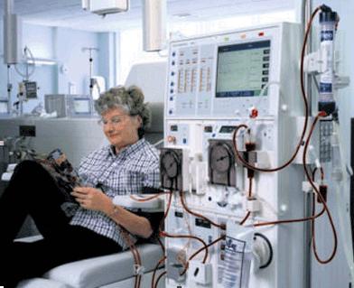 Una sesión de hemodiálisis
