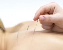 La acupuntura podría aliviar los síntomas de la EPOC