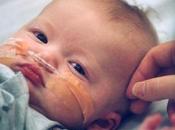 Bebés nacen síndrome rubéola congénita