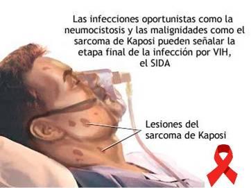 20120717131935-sida-en-cifras.jpg