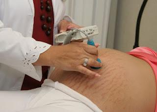 Embarazo y adolescencia, combinación que conlleva complicaciones de salud