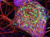 Neuronas Cordón Umbilical